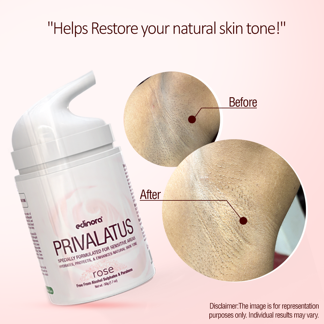 Edinora Privalatus Natural Private areas Skin Whitening Cream | Underarm Brightening Cream | with Vitamin E, Niacinamide, Shea Butter | Rose | 50g